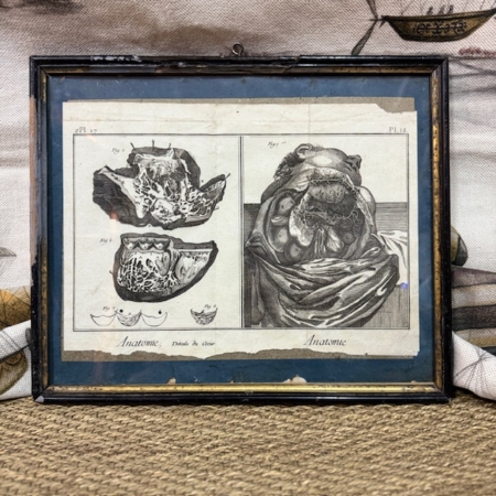 grabado anatómico francés siglo XIX